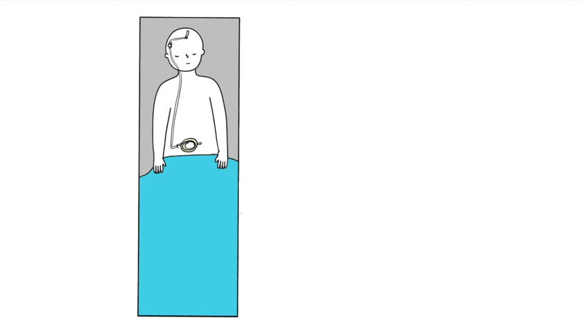 EVD and ICP Monitor Placement